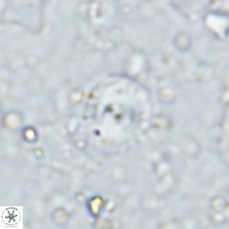 Cyclagelosphaera margerellii VR 12911