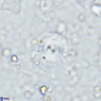 Cyclagelosphaera margerellii VR 12912