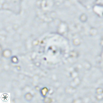 Cyclagelosphaera margerellii VR 12912