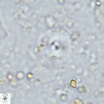 Cyclagelosphaera margerellii VR 12913