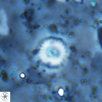Cyclagelosphaera margerellii VR 12920