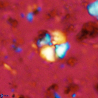 Cyclagelosphaera ovalicycla VR 11235