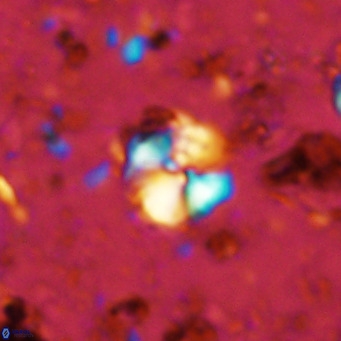 Cyclagelosphaera ovalicycla VR 11238