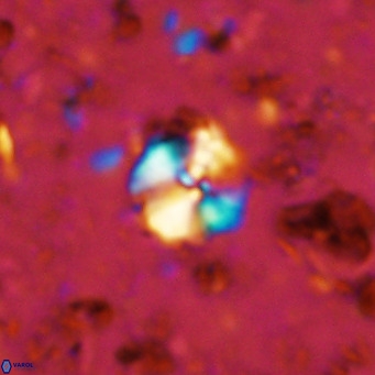Cyclagelosphaera ovalicycla VR 11244