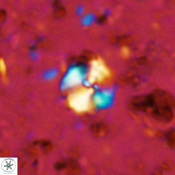 Cyclagelosphaera ovalicycla VR 11244