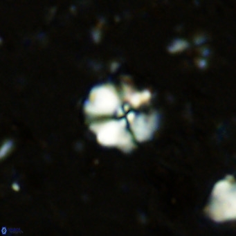 Cyclagelosphaera ovalicycla VR 11247