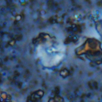 Cyclagelosphaera ovalicycla VR 11256