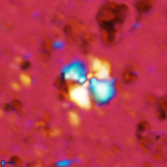 Cyclagelosphaera ovalicycla VR 11261