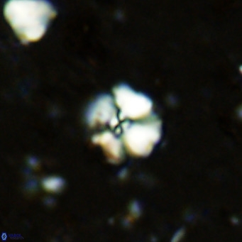 Cyclagelosphaera ovalicycla VR 11263