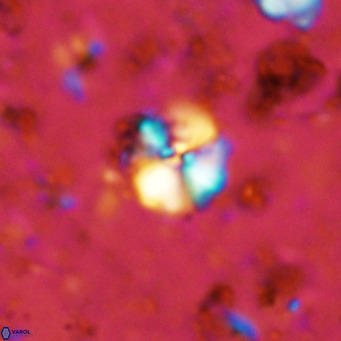 Cyclagelosphaera ovalicycla VR 11265