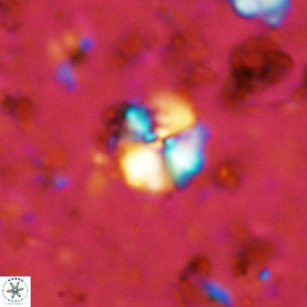 Cyclagelosphaera ovalicycla VR 11265