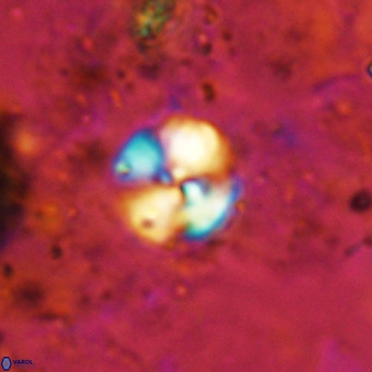 Cyclagelosphaera ovalicycla VR 15612