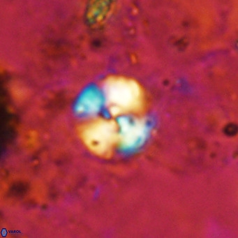 Cyclagelosphaera ovalicycla VR 15613