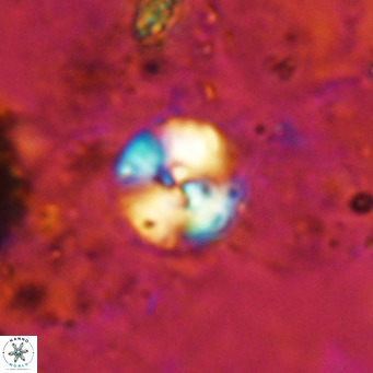 Cyclagelosphaera ovalicycla VR 15613