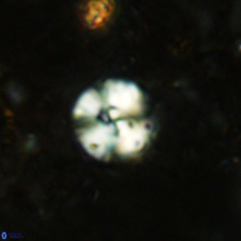 Cyclagelosphaera ovalicycla VR 15614