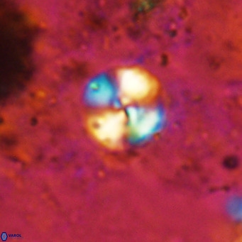 Cyclagelosphaera ovalicycla VR 15616