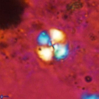 Cyclagelosphaera ovalicycla VR 15619