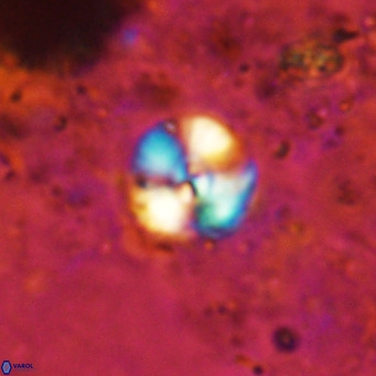 Cyclagelosphaera ovalicycla VR 15622