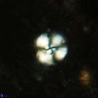 Cyclagelosphaera ovalicycla VR 15623