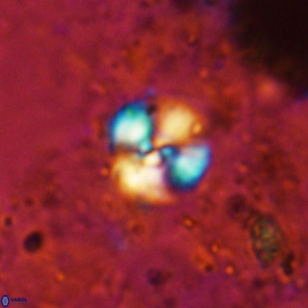 Cyclagelosphaera ovalicycla VR 15624