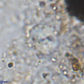 Cyclagelosphaera ovalicycla VR 15625