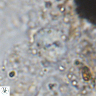 Cyclagelosphaera ovalicycla VR 15625