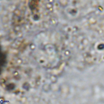 Cyclagelosphaera ovalicycla VR 15628