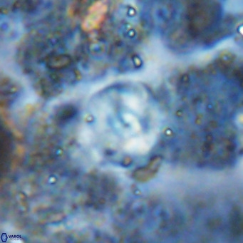 Cyclagelosphaera ovalicycla VR 15629
