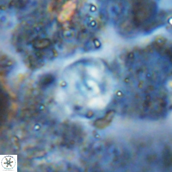Cyclagelosphaera ovalicycla VR 15629