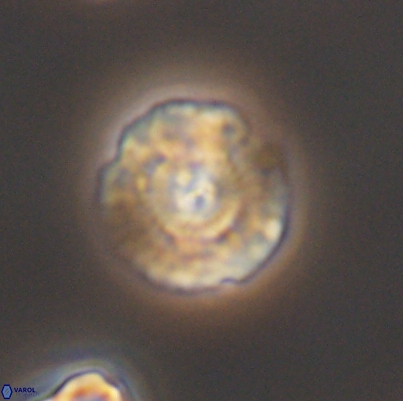 Cyclagelosphaera argoensis 12640