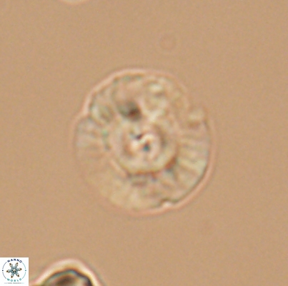 Cyclagelosphaera argoensis 12639