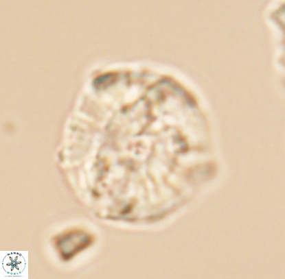 Cyclagelosphaera argoensis 12708