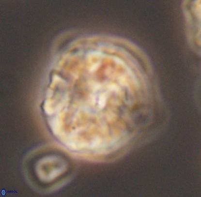 Cyclagelosphaera argoensis 12709