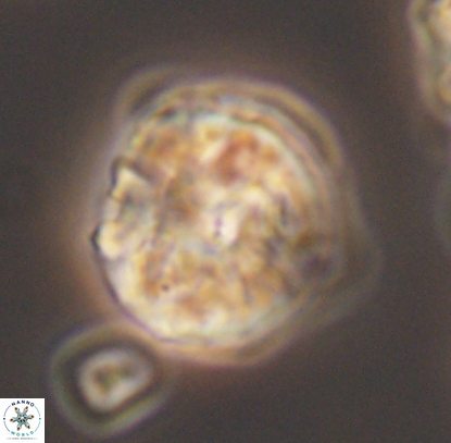 Cyclagelosphaera argoensis 12709