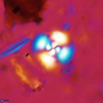 Cyclagelosphaera bergeri 38684
