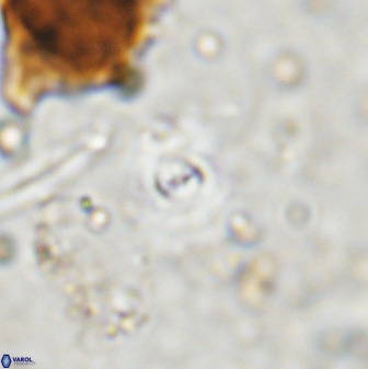 Cyclagelosphaera bergeri 38686