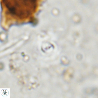 Cyclagelosphaera bergeri 38686