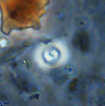 Cyclagelosphaera bergeri 38687