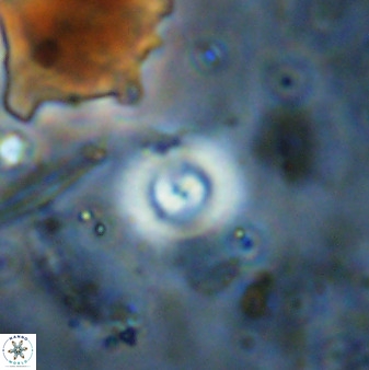 Cyclagelosphaera bergeri 38687