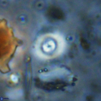 Cyclagelosphaera bergeri 38688