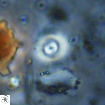 Cyclagelosphaera bergeri 38688