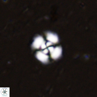 Cyclagelosphaera bergeri 41126