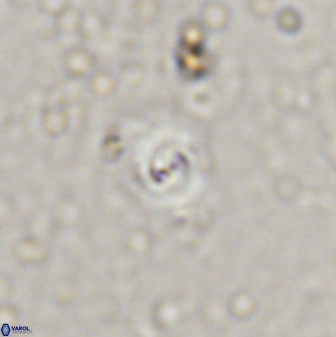 Cyclagelosphaera bergeri 41127