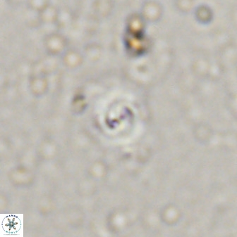 Cyclagelosphaera bergeri 41127