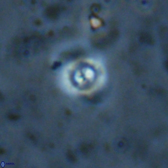 Cyclagelosphaera bergeri 41128