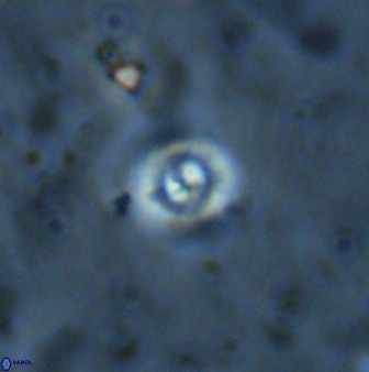 Cyclagelosphaera bergeri 41129