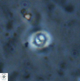 Cyclagelosphaera bergeri 41129