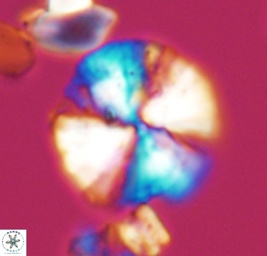 Cyclagelosphaera brezae 10533