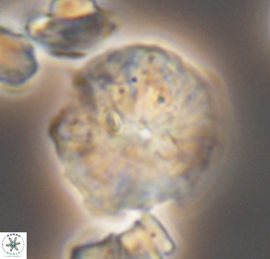 Cyclagelosphaera brezae 10534
