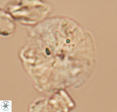 Cyclagelosphaera brezae 10535